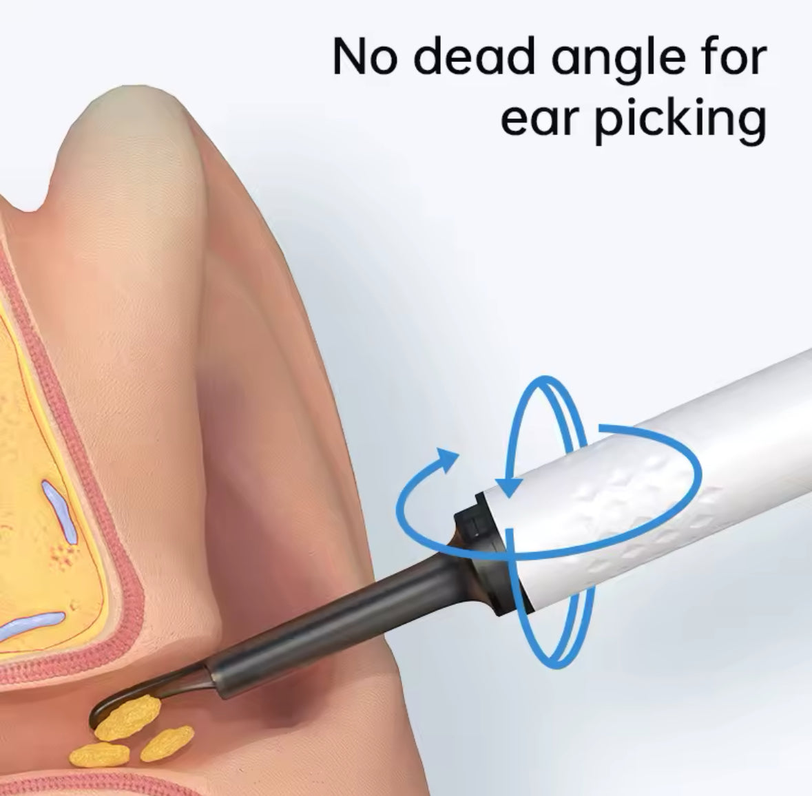 Electric Ear Cleaning Set with HD Camera